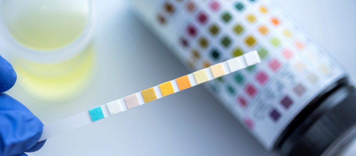 urinalysis